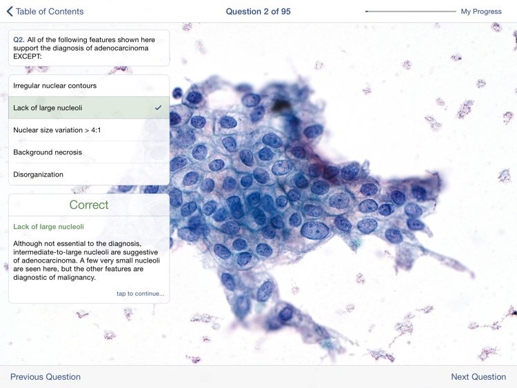 Johns Hopkins Atlas of Pancreatic Cytopathology screenshot-4