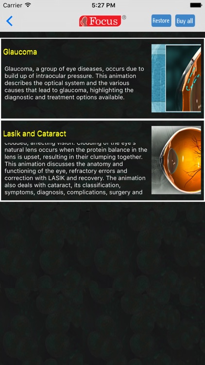 Ophthalmology - Understanding Disease