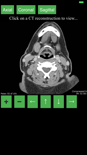 CT Neck