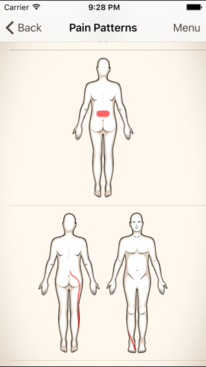 Clinical Pattern Recognition: Low back pain(圖2)-速報App