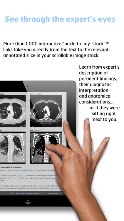 Thoracic Imaging - A Primer for Physicians screenshot-3