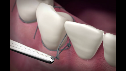 The Oral Surgery Suture Trainer Screenshot 3