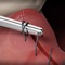The Oral Surgery Suture Trainer