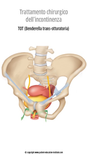 SIU, Urologia, phone app(圖2)-速報App