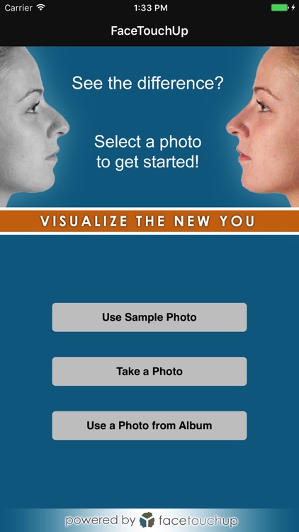 FaceTouchUp Nose Job & Rhinoplasty Simulator