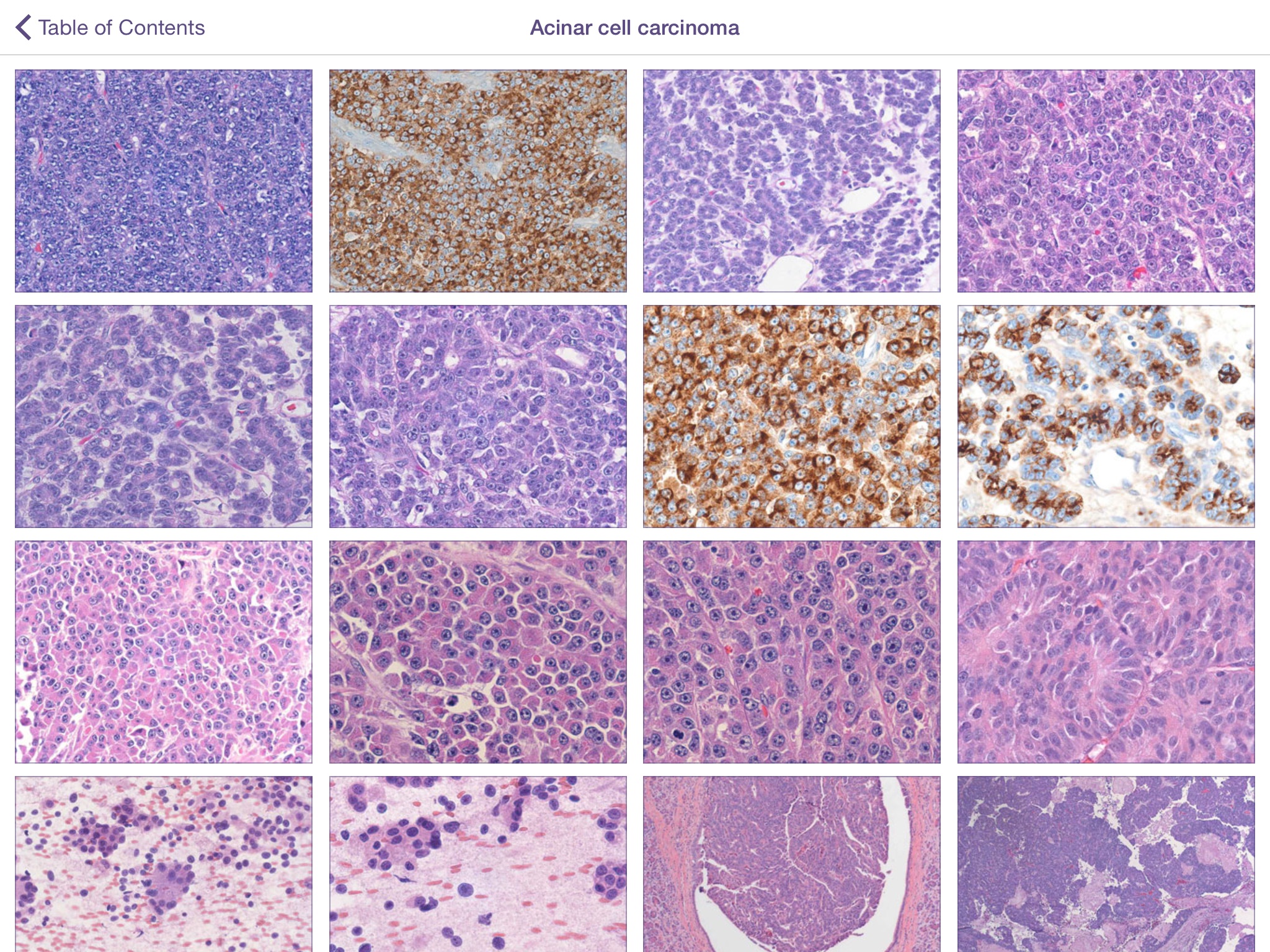 Johns Hopkins Atlas of Pancreatic Pathology screenshot 2