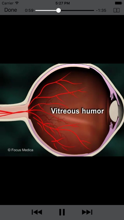 Ophthalmology - Understanding Disease screenshot-3