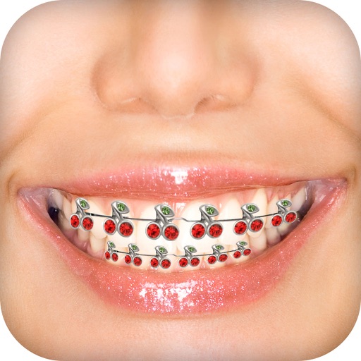 Braces Camera Photo Editor