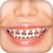 Braces Camera Photo Editor app helps you check how's you look in Different types of Braces
