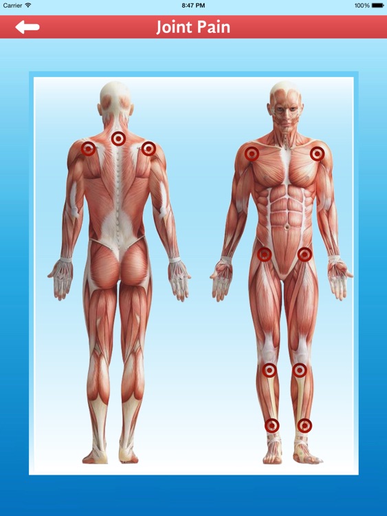 Cupping Therapy