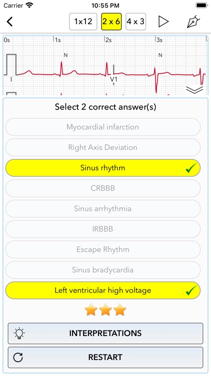 ECG Test for Doctors screenshot-3