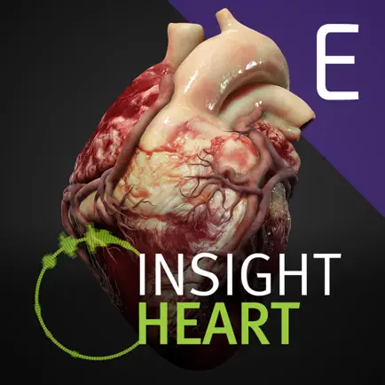 INSIGHT HEART Enterprise Cheats