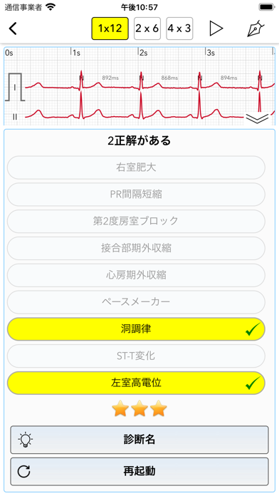 ECG Test Pro screenshot1