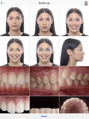 Captura de Pantalla 2 Dental Shooting iphone