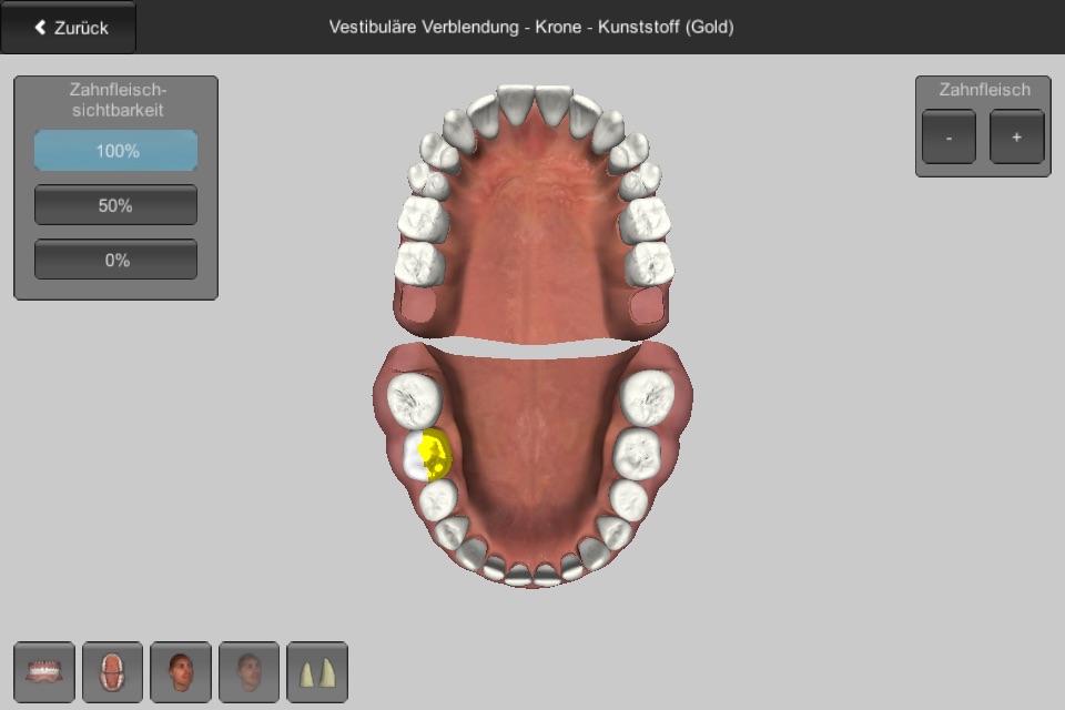 CGM VISODENT 3D App screenshot 4