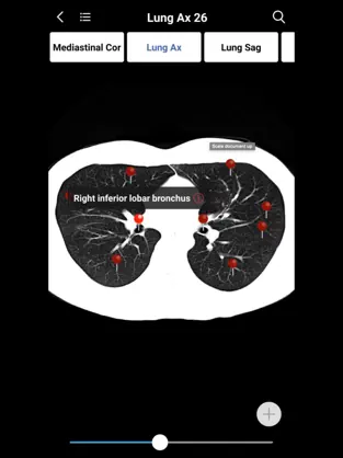 Screenshot 6 MedImaging-Radiology Made Easy iphone