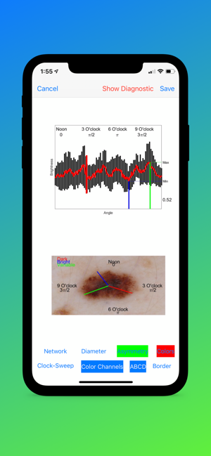 Eclass Imaging Biomarkers(圖1)-速報App