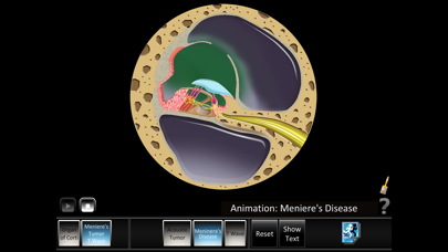 How to cancel & delete Ear Disorders: Inner from iphone & ipad 2