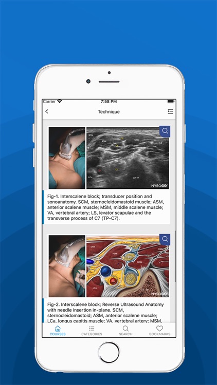 NYSORA Nerve Blocks screenshot-4