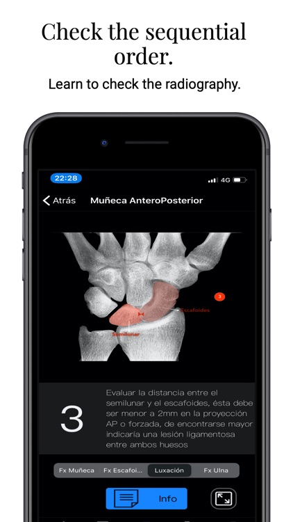XRay Assistant screenshot-3