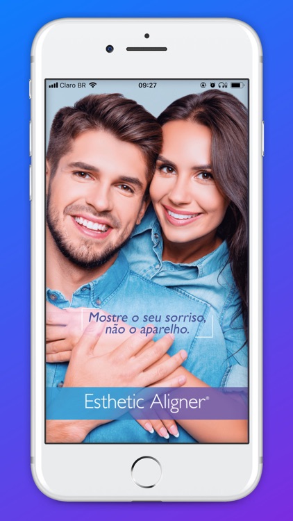 Esthetic Aligner