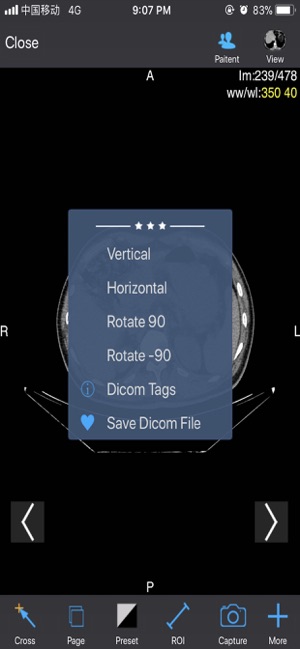 BestDicom - Easy and Powerful(圖4)-速報App