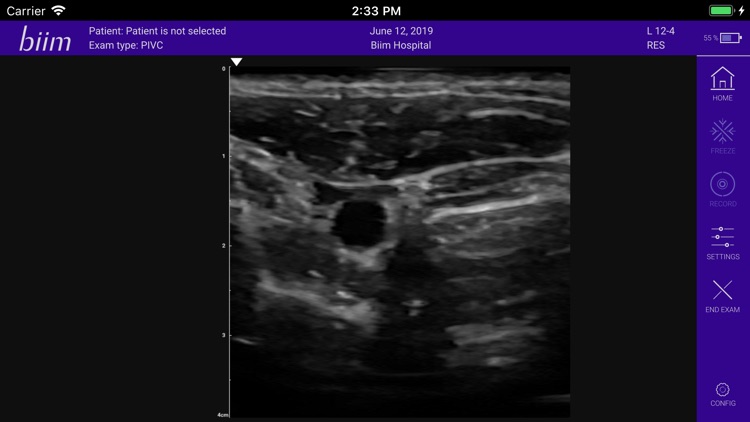 Biim Ultrasound