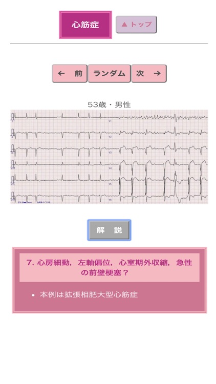 ポケット心電図 screenshot-5