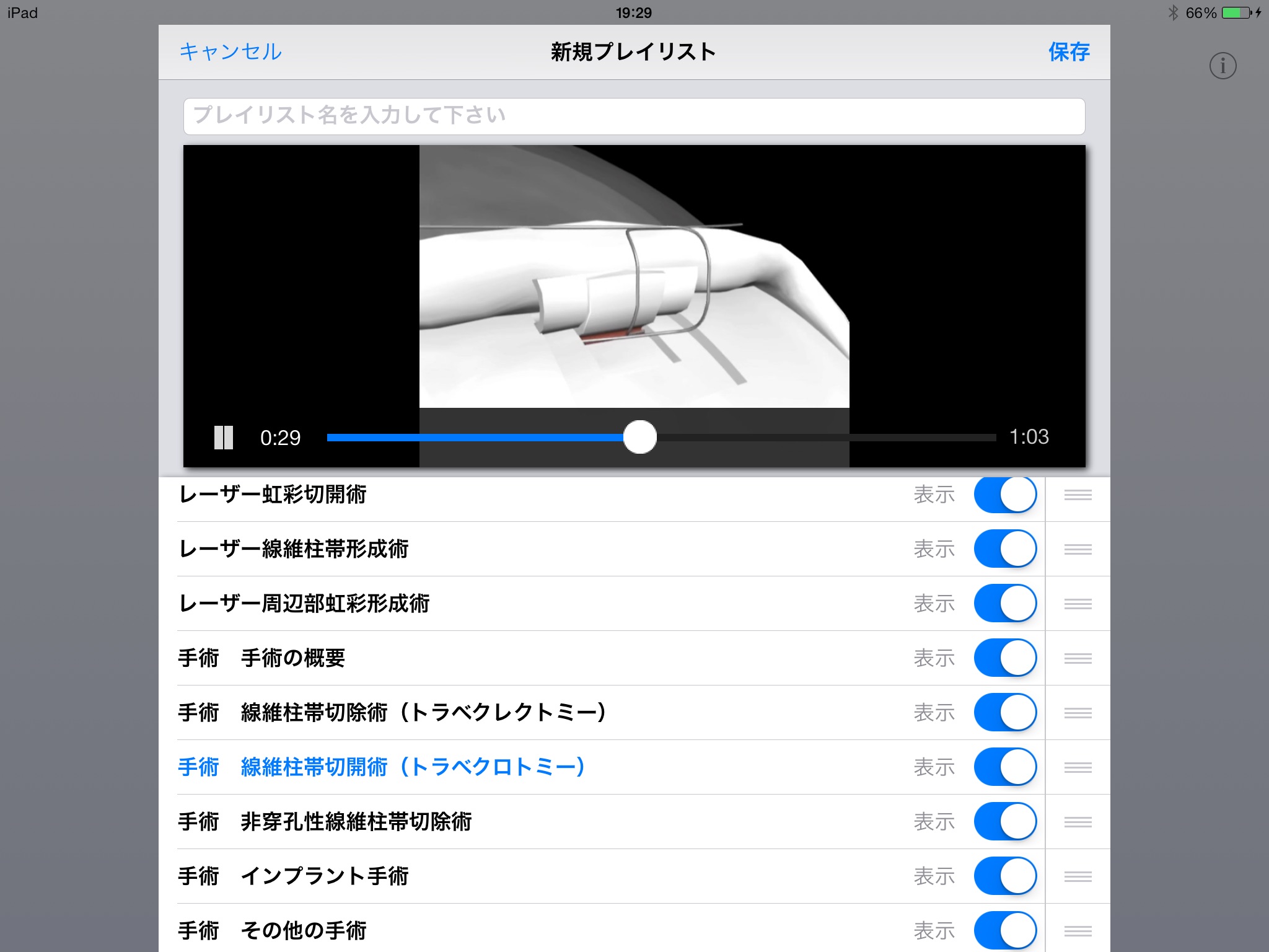 iCeye 緑内障 screenshot 3