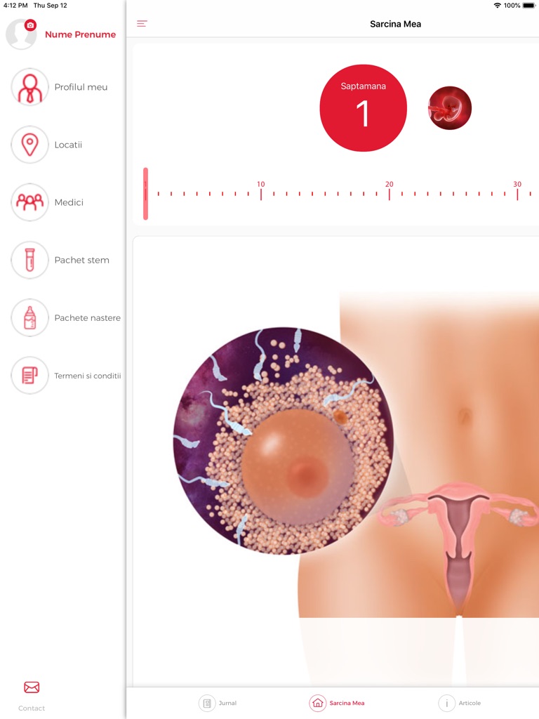 【图】SARCINA MEA(截图3)