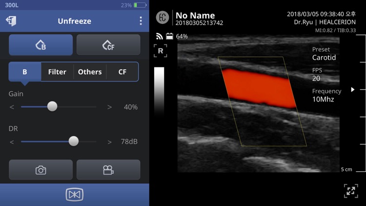 SONON Ultrasound App KR