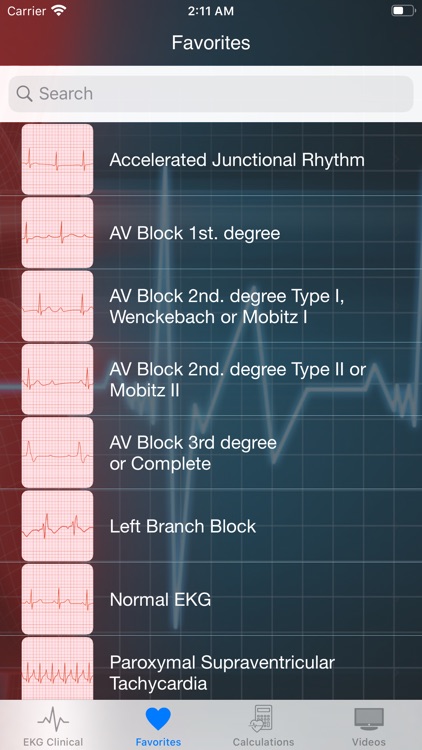 EKG Clinical screenshot-4