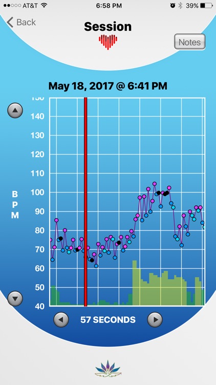 HRV Trace