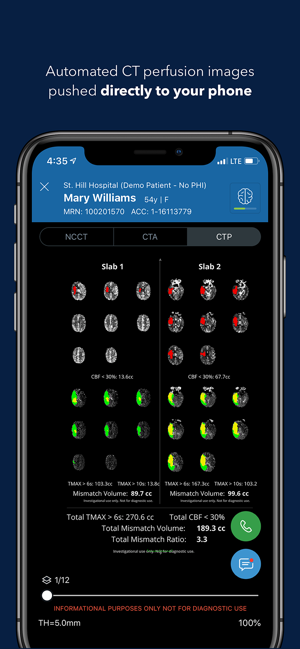 Viz Training AI Stroke Care(圖1)-速報App