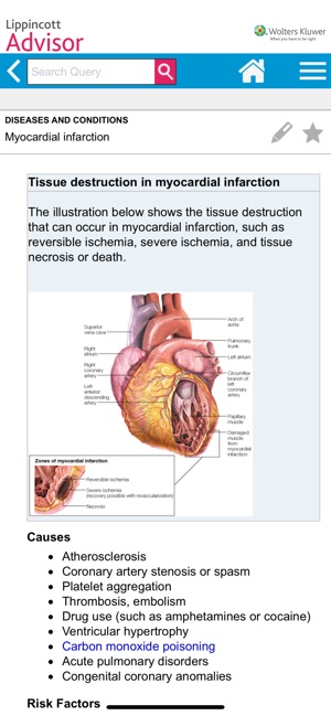 Lippincott Nursing Advisor(圖2)-速報App