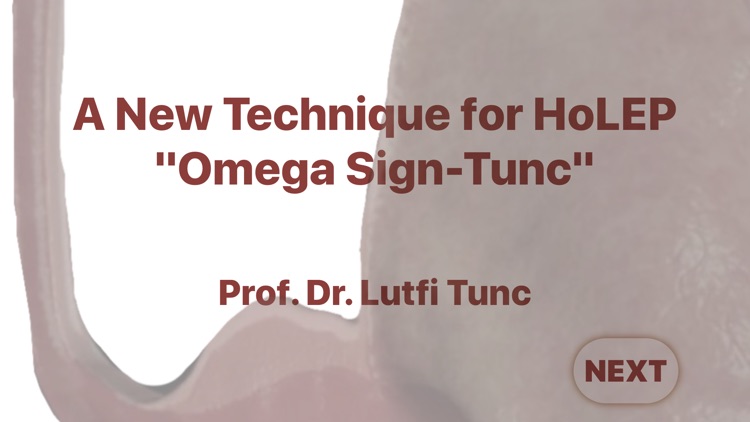 Omega Sign-Tunc