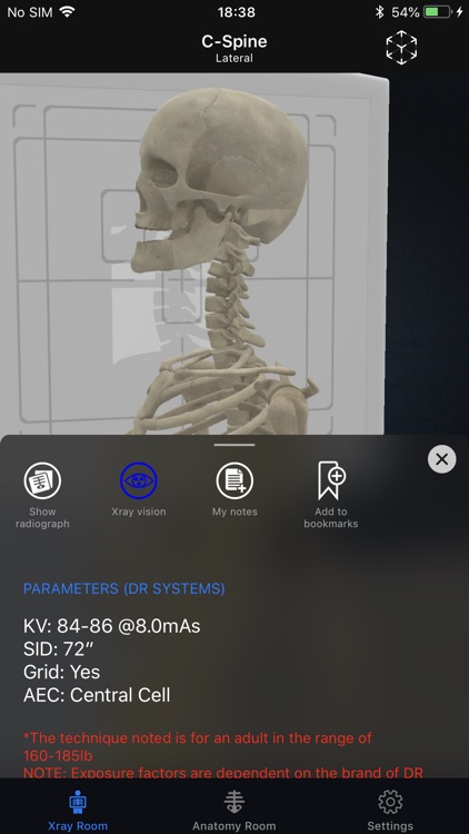iRad Xrays