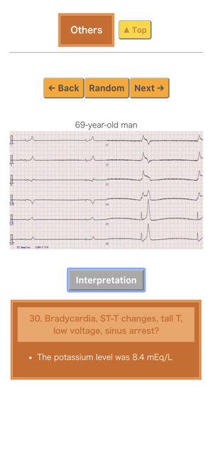 Pocket ECG(圖7)-速報App