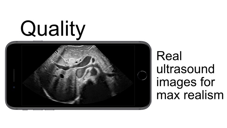 Scanbooster Ultrasound Sim screenshot-5
