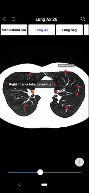 MedImaging-Radiology Made Easy(圖6)-速報App