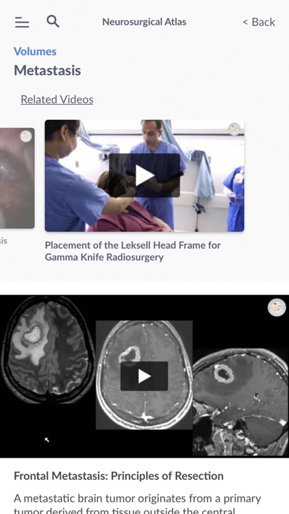 Neurosurgical Atlas