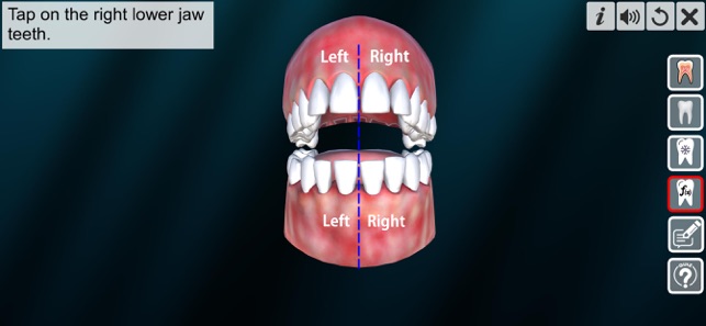 Incredible Human Teeth(圖5)-速報App