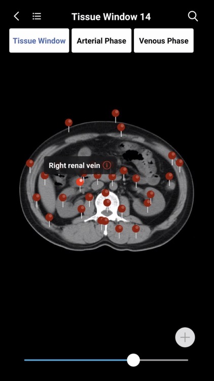 MedImaging-Radiology Made Easy screenshot-7