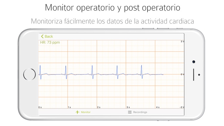 eKuore ECG