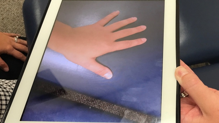 Mirror Box: CRPS & RSD, Stroke screenshot-4