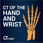 CTisus: CT of the Hand & Wrist