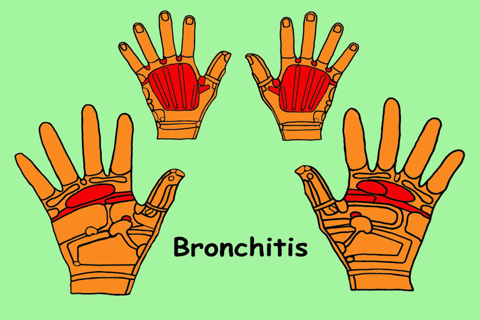 Treat Your Hands - Reflexology - náhled