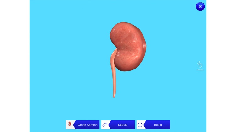 Kidney AR