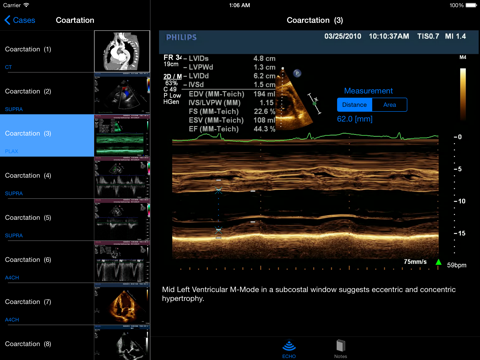 CARDIO3®Echocardiography HD - náhled
