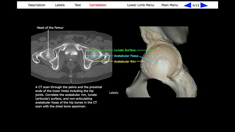 Human Skeleton: Gross Anatomy screenshot-9